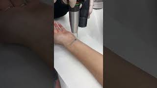 Fast laser tattoo removal [upl. by Einner238]