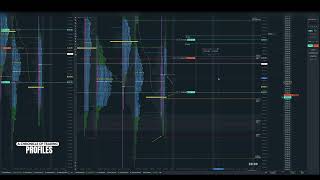 10032024 ES  Trading Market Profile amp Volume Profile [upl. by Annael197]