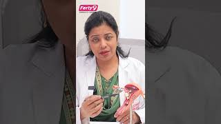 Pain During Intercourse  Causes Of Endometriosis  Ferty9  shorts trending endometriosis [upl. by Devaj]