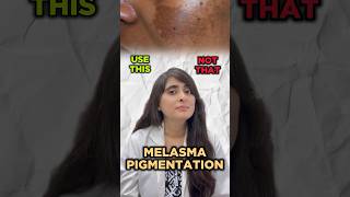 How to treat Melasma  Melasma treatment by dermatologist  Pigmentation  Pigmentation on face [upl. by Lladnik934]