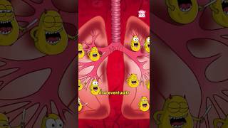 How TB Attacks the Body  World Tuberculosis Day 2024 diseases TB drbinocsshow peekabookidz [upl. by Akeit]