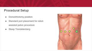 ketamine bladder  Studer Type Neobladder Augment [upl. by Anahpos]