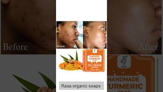 Turmeric soap benefits organicskincaresoaprasaorganicproductsviralvideoshortvideoOrdernow [upl. by Elburr]