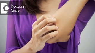 Causes of generalized itching without rash  Dr Rashmi Ravindra [upl. by Oralie]