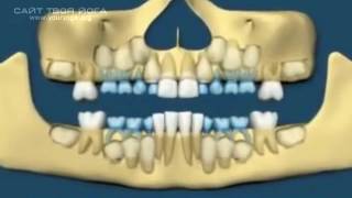 Заговор на рост новых молодых зубов [upl. by Semreh517]