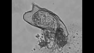 Hatching of a Schistosoma Mansoni Miracidium [upl. by Leind]