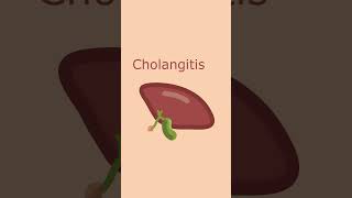 Cholangitis vs Cholecystitis  Short Comparison science biology anatomy medicine [upl. by Studner414]