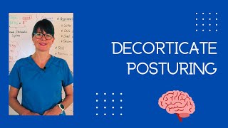 Decorticate Posturing shorts [upl. by Ekusuy]