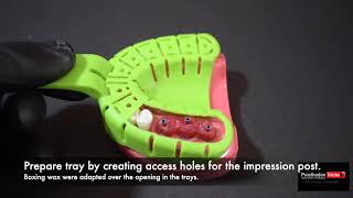 Impression Techniques for Implant Dentistry Step by Step Splinted open tray Impression technique [upl. by Hardie489]