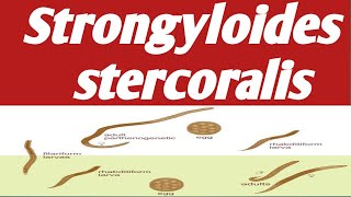 Strongyloides stercoralis  Ahmaric Tutorial [upl. by Llehsyt706]