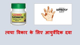 Talkeshwar ras l Leprosy l ayurvedictreatment ayurveda ayurvedicmedicines [upl. by Anertal555]