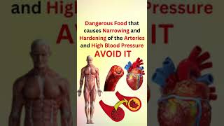 Dangerous food that causes narrowing and hardening of the arteries and high blood pressure avoid it [upl. by Alina]