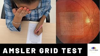 Amsler grid test II Central visual field test II screening test for macular degeneration [upl. by Ynohtnaed]