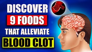 9 Everyday Foods with Hidden Blood ClotDissolving Powers [upl. by Stock]