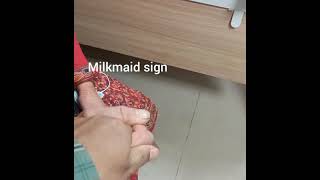 Milkmaid sign in patient with Huntington choreamedicine classroom [upl. by Ballman]