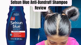 Selsun Blue AntiDandruff Shampoo Reviews Effective or Not [upl. by Kikelia430]