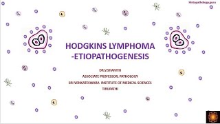 Hodgkins lymphoma  Etiopathogenesis [upl. by Yltnerb]