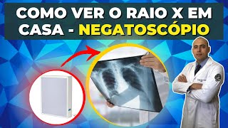 COMO VER O SEU RAIO X EM CASA  NEGATOSCÓPIO CASEIRO  MÉTODO SIMPLES E RÁPIDO [upl. by Tap]