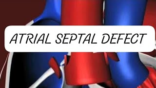 ATRIAL SEPTAL DEFECT CONGENITAL HEART DISEASE [upl. by Narrad723]