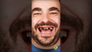 Dientes de tus antepasados 👉🦷 curiosidades [upl. by Eremahs]