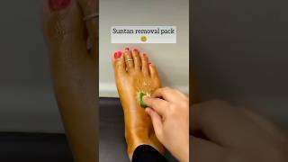 🔥Get Fair Feet InstantlyMost Easy PedicureRemove Slippers Markamp Dead Skin Cellsskinshortsviral [upl. by Ennaul]