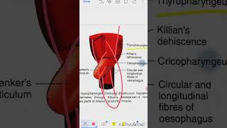 Pharyngeal Pouch Zenkers Diverticulum [upl. by Yerggoeg]