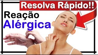 🔥 O QUE CARACTERIZA UMA REAÇÃO ALÉRGICA O QUE PODE PROVOCAR UMA REAÇÃO ALERGICA [upl. by Goldwin]