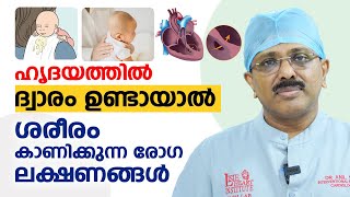 ഹൃദയത്തിൽ ദ്വാരം ഉണ്ടായാൽ ശരീരം കാണിക്കുന്ന രോഗ ലക്ഷണങ്ങൾ  Congenital Heart Disease  Dr Anil SR [upl. by Ron]