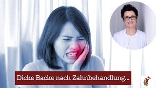 Dicke Backe nach Zahnbehandlung [upl. by Morentz545]