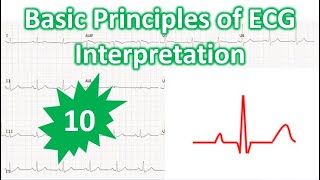 Basic Principles of ECG Interpretation  10 [upl. by Mairb]