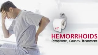 Hemorrhoids Pile [upl. by Osher]