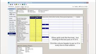 Charting on Powerforms [upl. by Natiha]