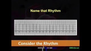 Intro EKG Interpretation Part 2 [upl. by Llehsad402]