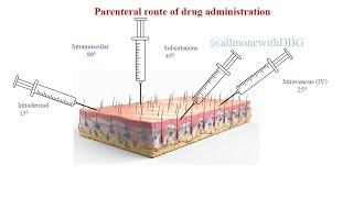 Parenteral routePart 2Routes of Drug administration pharmacology pharmacy [upl. by Nauqed]