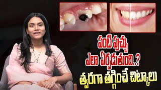 What Causes Tooth Decay  పంటి పుచ్చు ఎలా ఏర్పడుతుందిత్వరగా తగ్గించే చిట్కాలు  TheDoctorTV [upl. by Ardnossac]