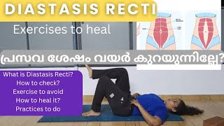 Diastasis Recti practices to heal പ്രസവ ശേഷം ഉള്ള വയറു കുറയ്ക്കാം Core exercise to do for healing [upl. by Sidhu992]