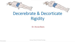 Decrebrate amp Decorticate Rigidity [upl. by Durrett]