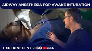 Airway Anesthesia for Awake Intubation  Crash course with Dr Hadzic [upl. by Ariamat182]