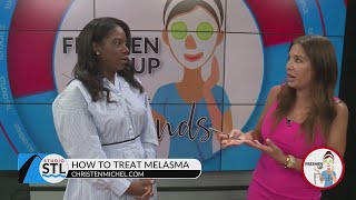 How to help a common skin condition of Melasma [upl. by Eidak933]