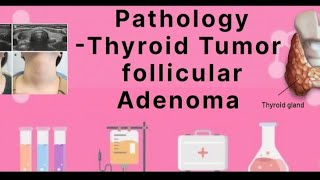 Pathology  Thyroid tumor Follicular Adenoma [upl. by Rolph]