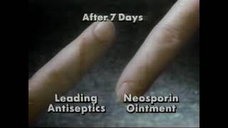 Neosporin Commercial 1991 [upl. by Atsyrhc]