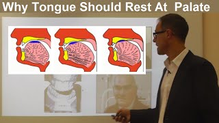 Should Tongue Rest Touch at the Palate Maxilla Roof of the Mouth By Dr Mike Mew [upl. by Handler]