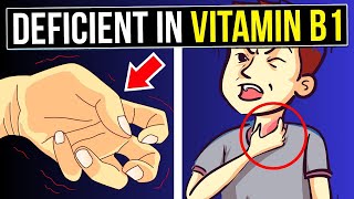 8 Warning Signs You’re DEFICIENT In VITAMIN B1 [upl. by Geri251]