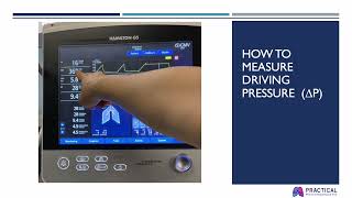 Measuring Respiratory System Elastance during Controlled Mechanical Ventilation Why and How [upl. by Ola]