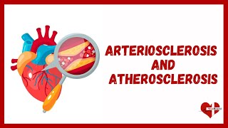 What is Atherosclerosis  Overview of Atherosclerosis and Arteriosclerosis  MedBoard [upl. by Mccreary539]