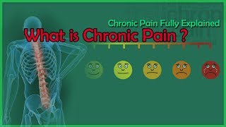 What Is Chronic Pain  Central Sensitivity Syndrome CSS Living W Chronic Pain Fully Explained [upl. by Moise]