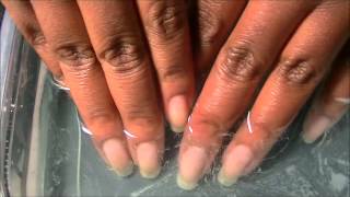 How to Whiten Nails in Minutes with Denture Tablets [upl. by Torin]