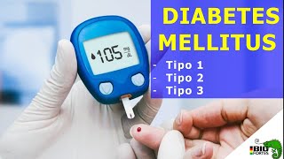 Diabetes Mellitus tipo 1 tipo 2 e tipo 3 [upl. by Anicnarf]