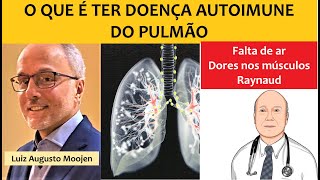 O que é ter doença autoimune do pulmão Fibrose pulmonar [upl. by Mitchael]