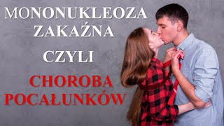 Mononukleoza Zakaźna czyli Choroba Pocałunków Co to jest Jak się zarazić Objawy Leczenie Wirus [upl. by Klecka782]